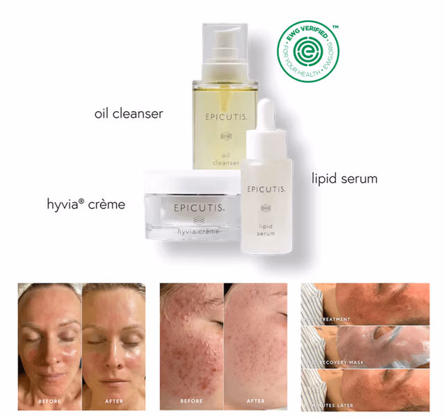 LUXURY SKINCARE SET- Epicutis LUXURY SKINCARE SET- Epicutis