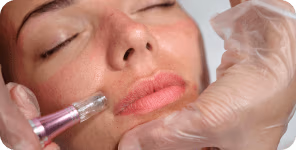 Promotions5 | Anara Medspa Promotions5 | Anara Medspa