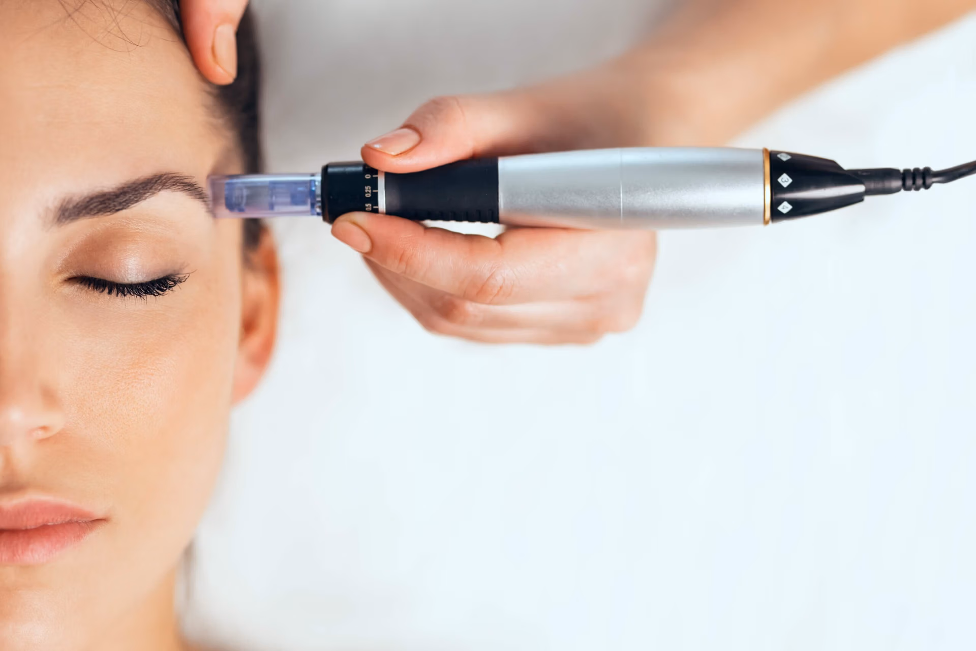 Microneedling in New Jersey Microneedling in New Jersey