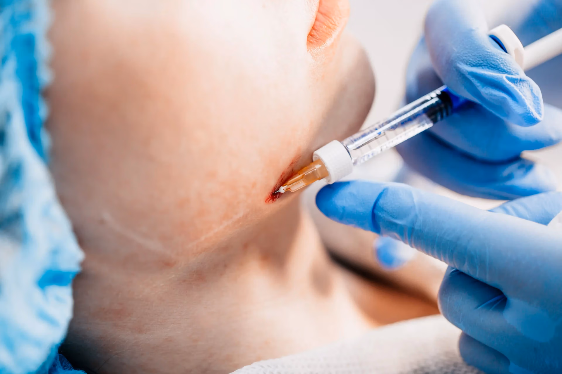 Jaw augmentation in East Brunswick, New jersey Jaw augmentation in East Brunswick, New jersey